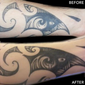 tattoo-before-after2